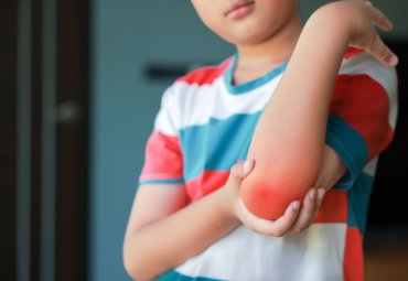 Estudio de la PUCV revela vínculo clave entre obesidad infantil, rendimiento físico y salud ósea