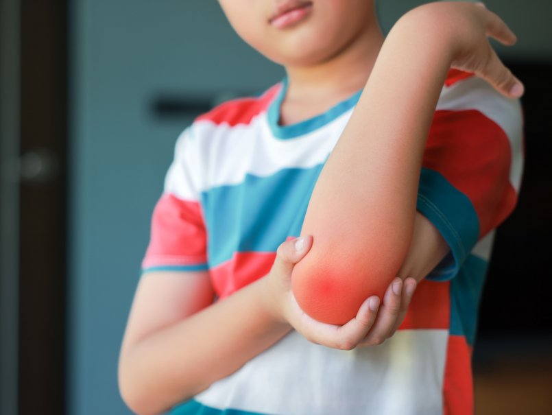 Study at the PUCV reveals key connection between child obesity, physical performance and bone health